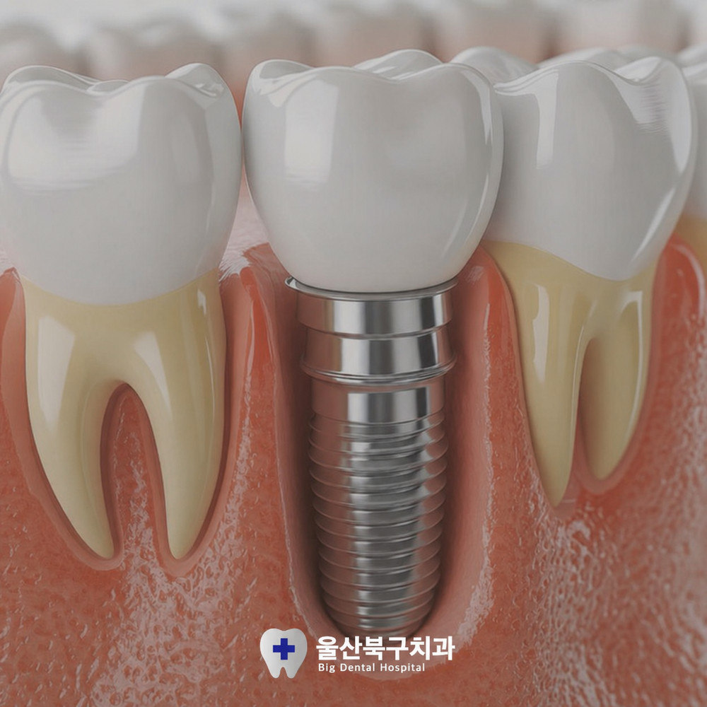 울산북구치과 생활 속 치아 사용 빈도보다 관리가 소홀해지는 이유와 중요성