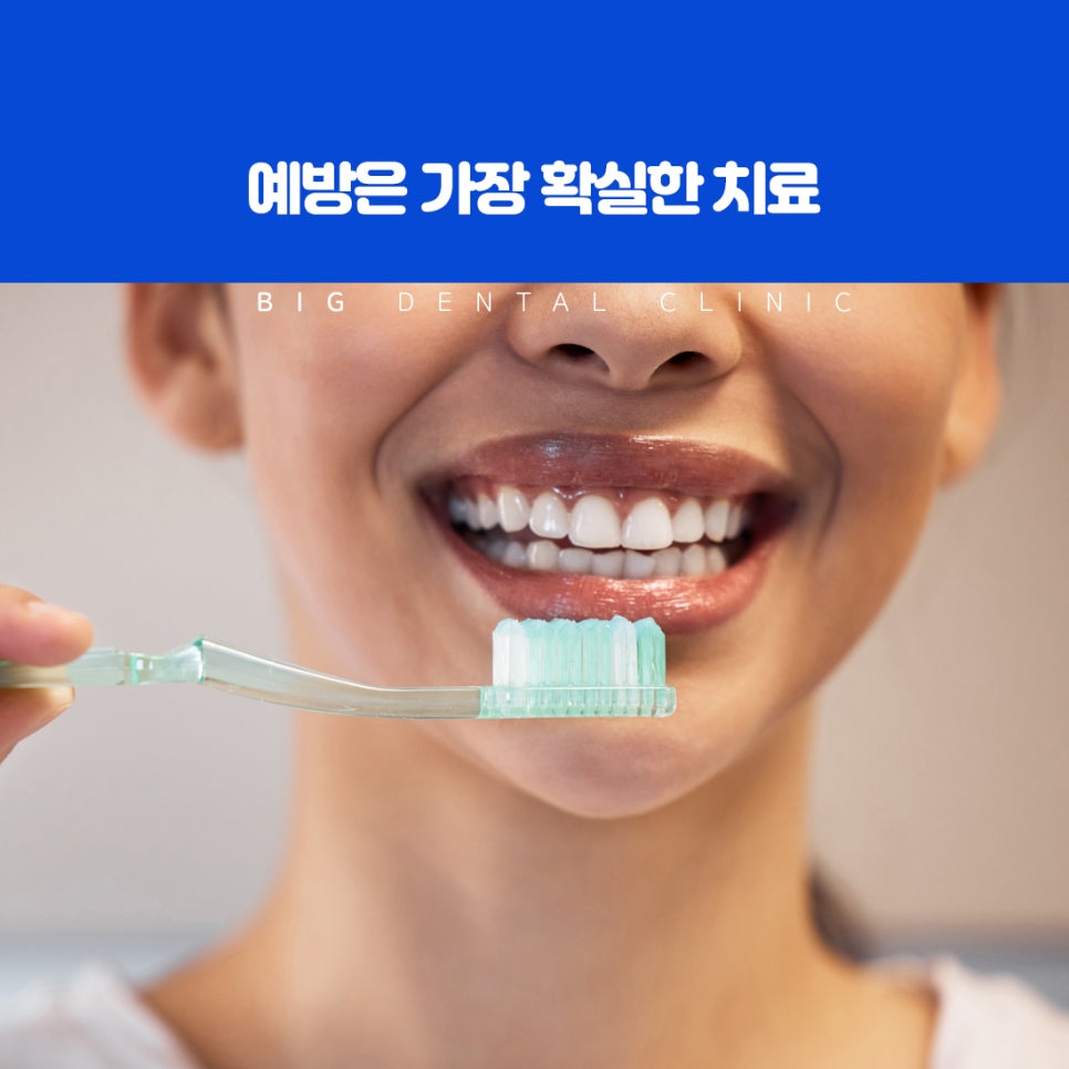 울산북구치과 오래된 레진 아말감 아래 재충치 정기 검진과 엑스레이 확인 방법