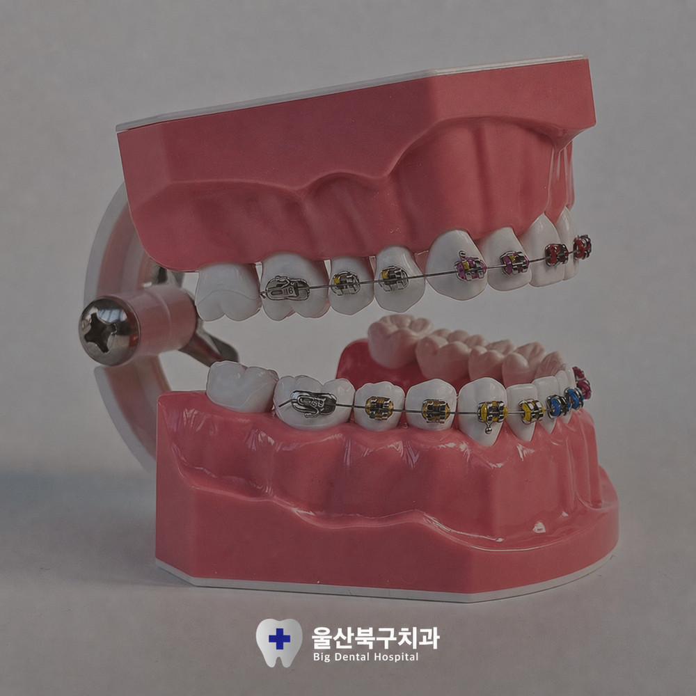울산북구치과 치아교정 자연스러운 미소와 바른 치아 정렬의 가치 선택 전 확인할 이유