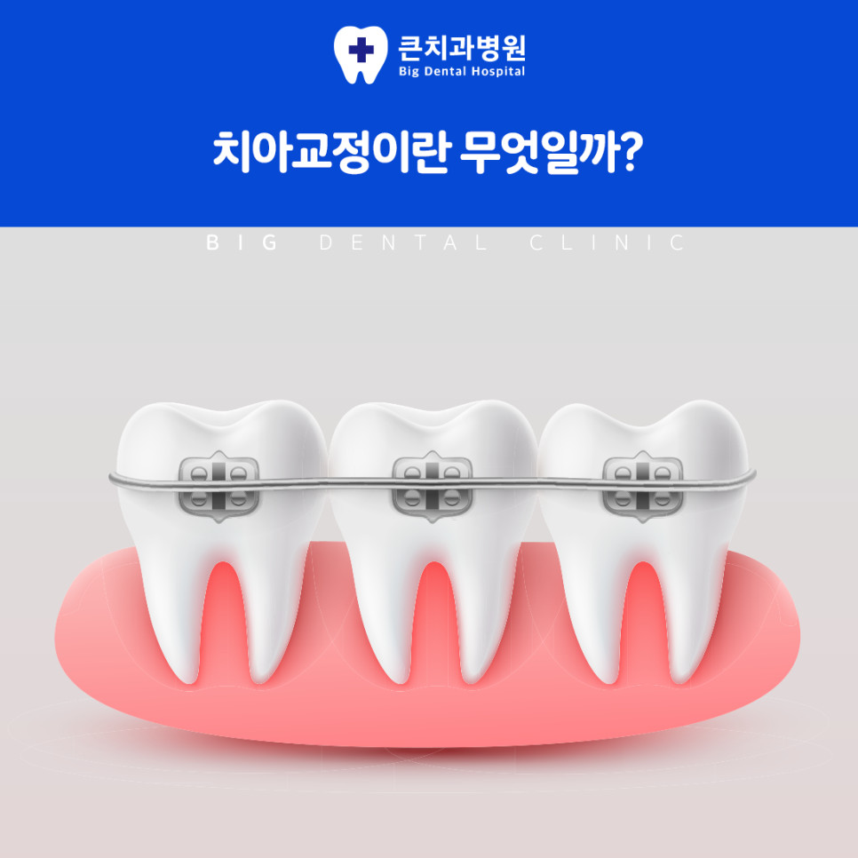 울산북구치과 치아교정이 발음 저작 습관 얼굴 균형을 함께 고려하는 이유와 기준