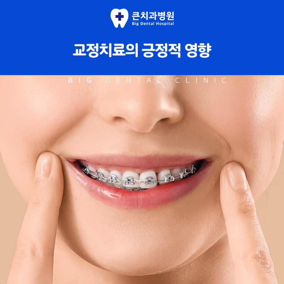 울산북구치과 치아교정 삐뚤어진 치아 배열과 교합 맞춤 치료 과정 이해 방법