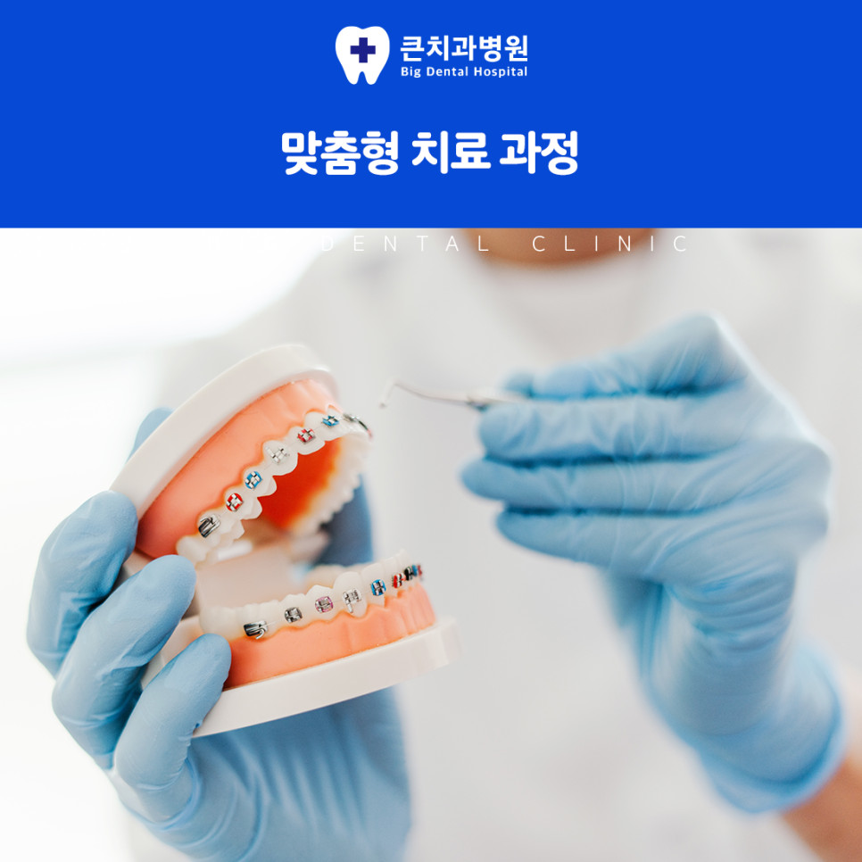 울산북구치과 고르지 않은 치아 배열의 음식물 끼임과 위생 관리 주의사항 정리