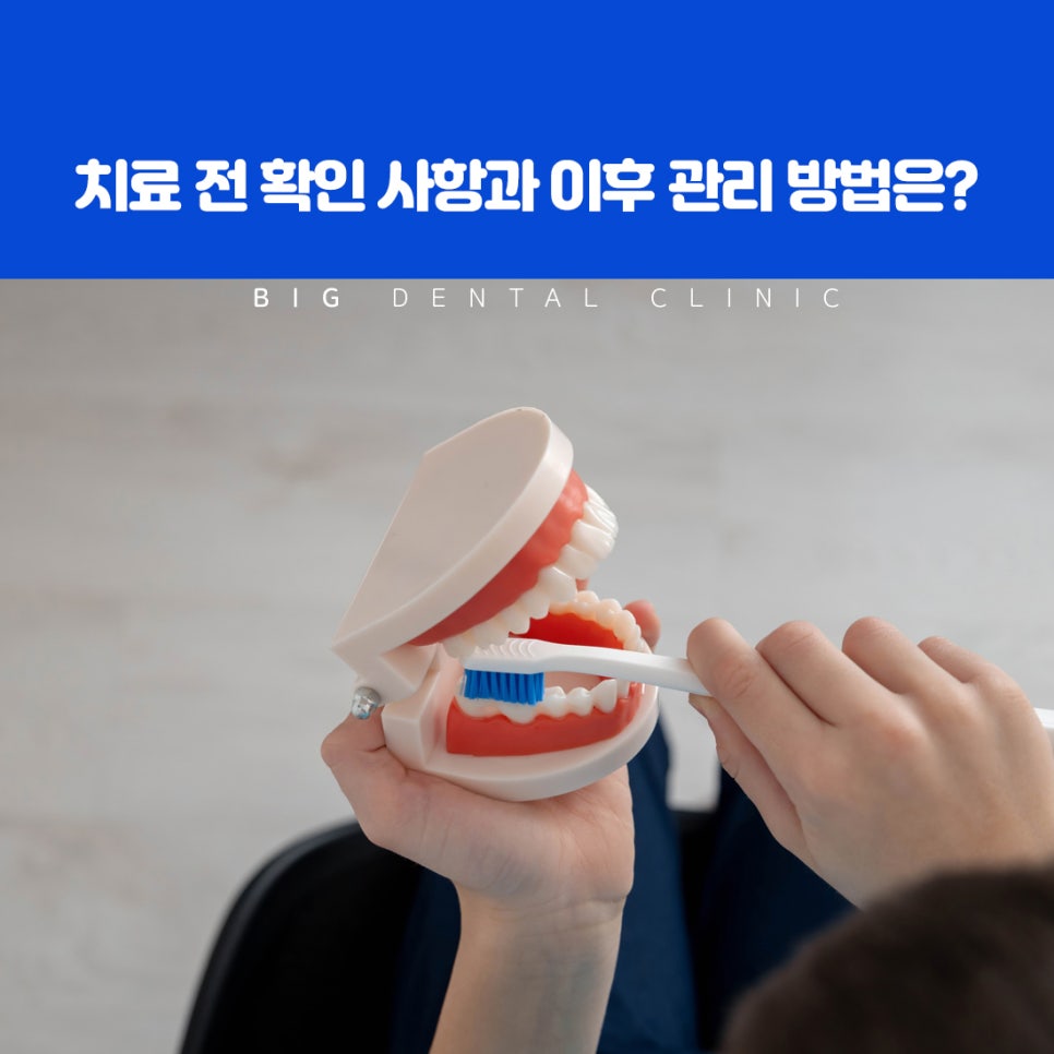 울산북구전악임플란트 대안 검토 상황 틀니 흔들림과 이물감 식사 불편 개선