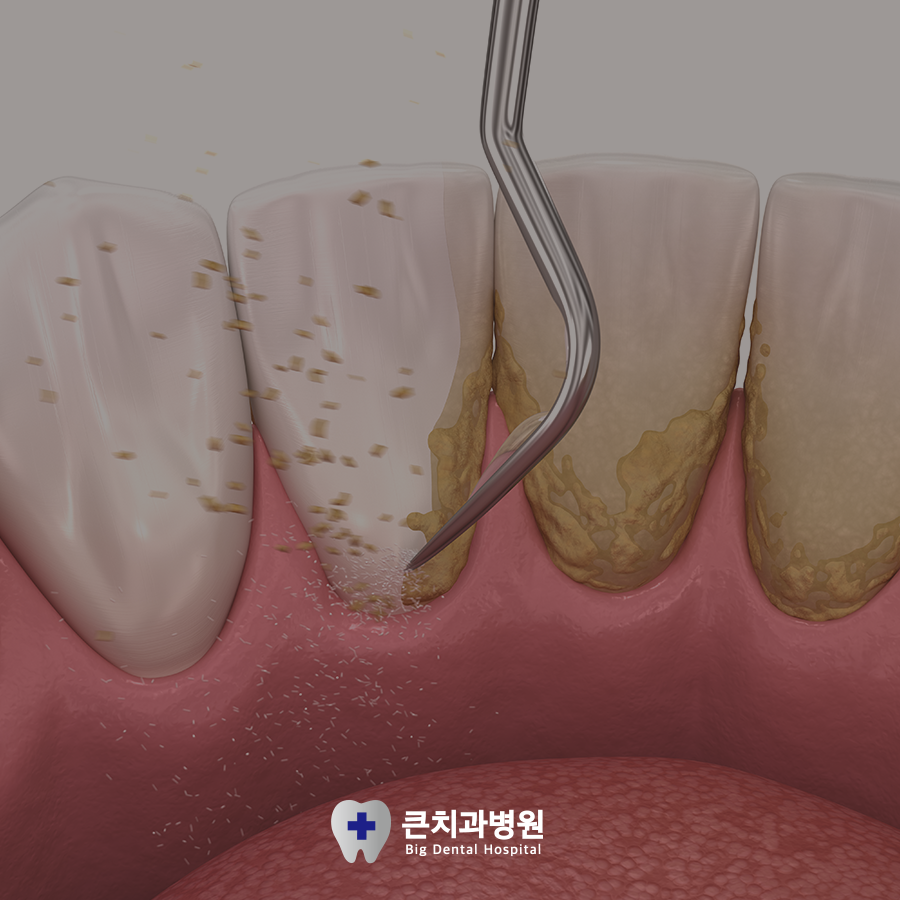 울산북구치과