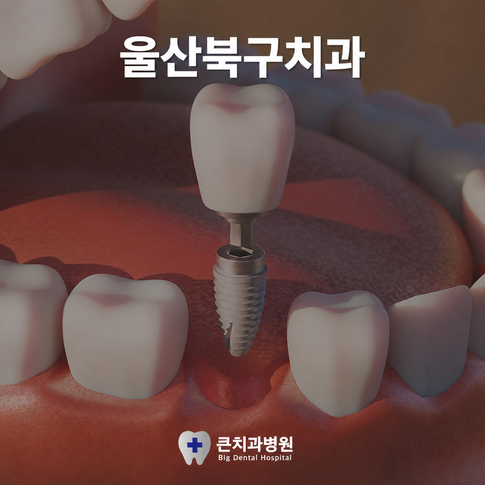 치아 손실로 울산북구치과를 찾는 환자의 씹기 불편