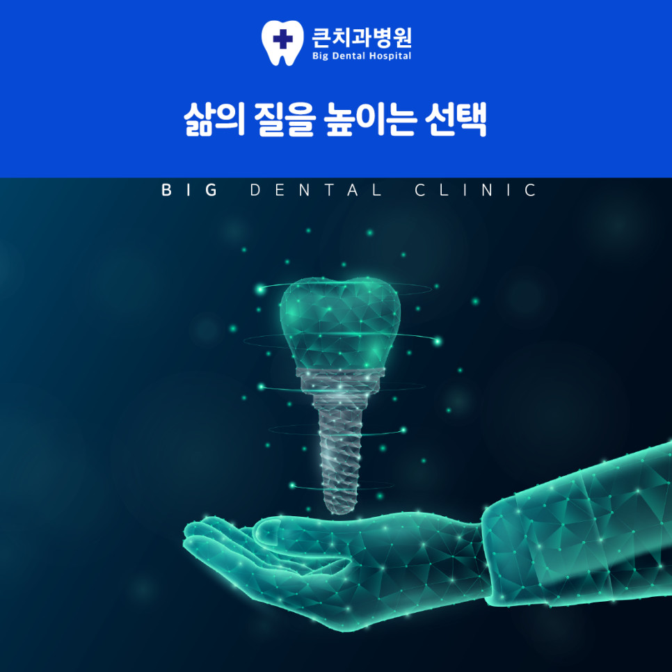프랑스 앤서지 임플란트를 소개하는 안내문