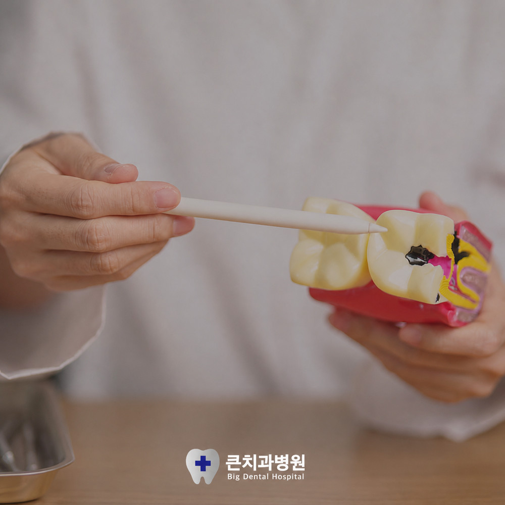 통증이 없어도 울산북구치과 검진이 필요한 충치