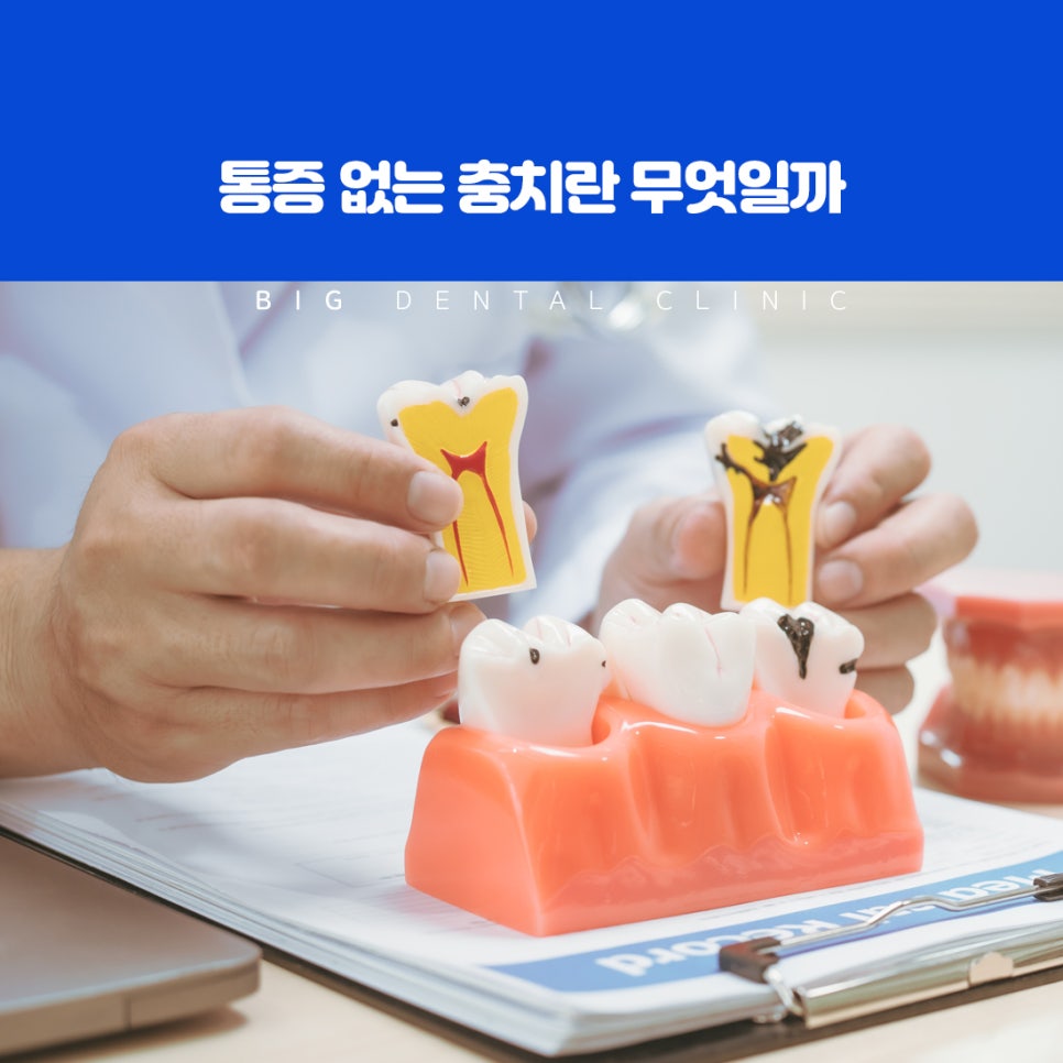 초기 단계에 발견되는 증상이 없는 충치