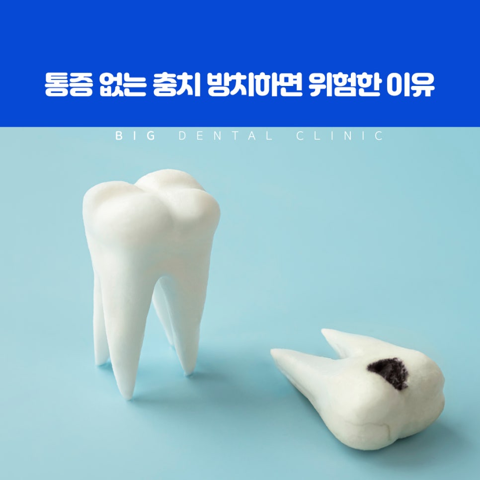 눈에 띄지 않아도 살펴야 하는 치아 내부 변화