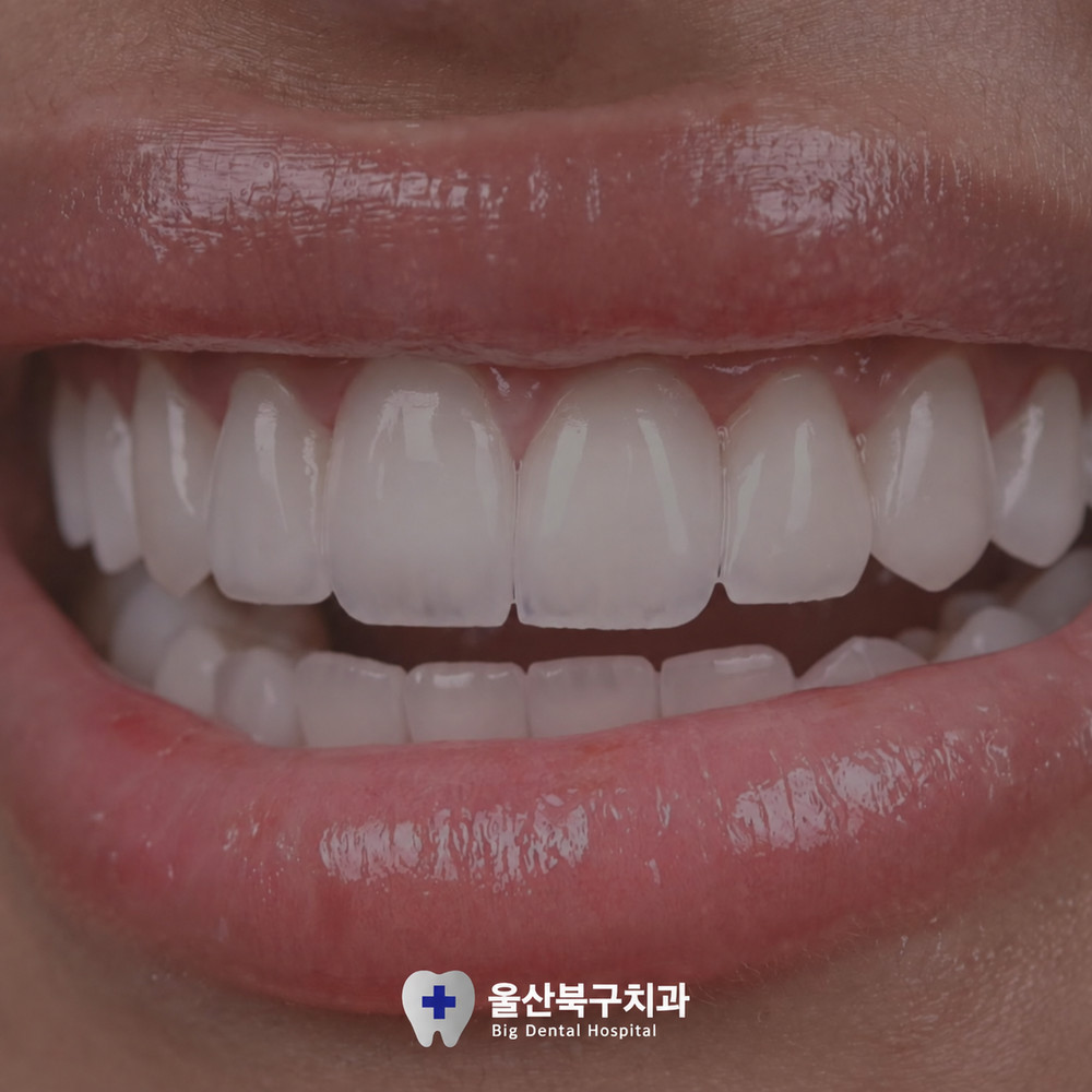 거울을 보며 어둡게 변한 치아 색을 확인하는 모습