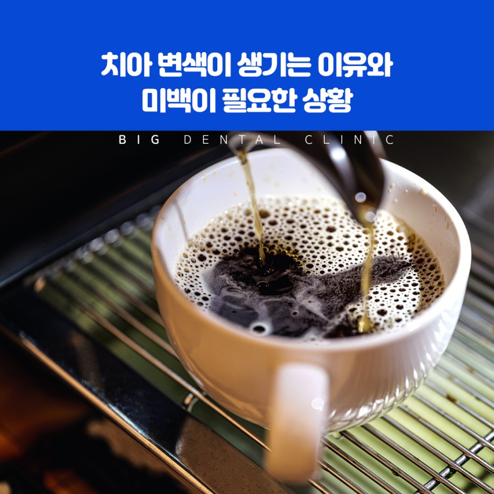 대화 중 치아 색이 신경 쓰여 웃음을 조심하는 순간