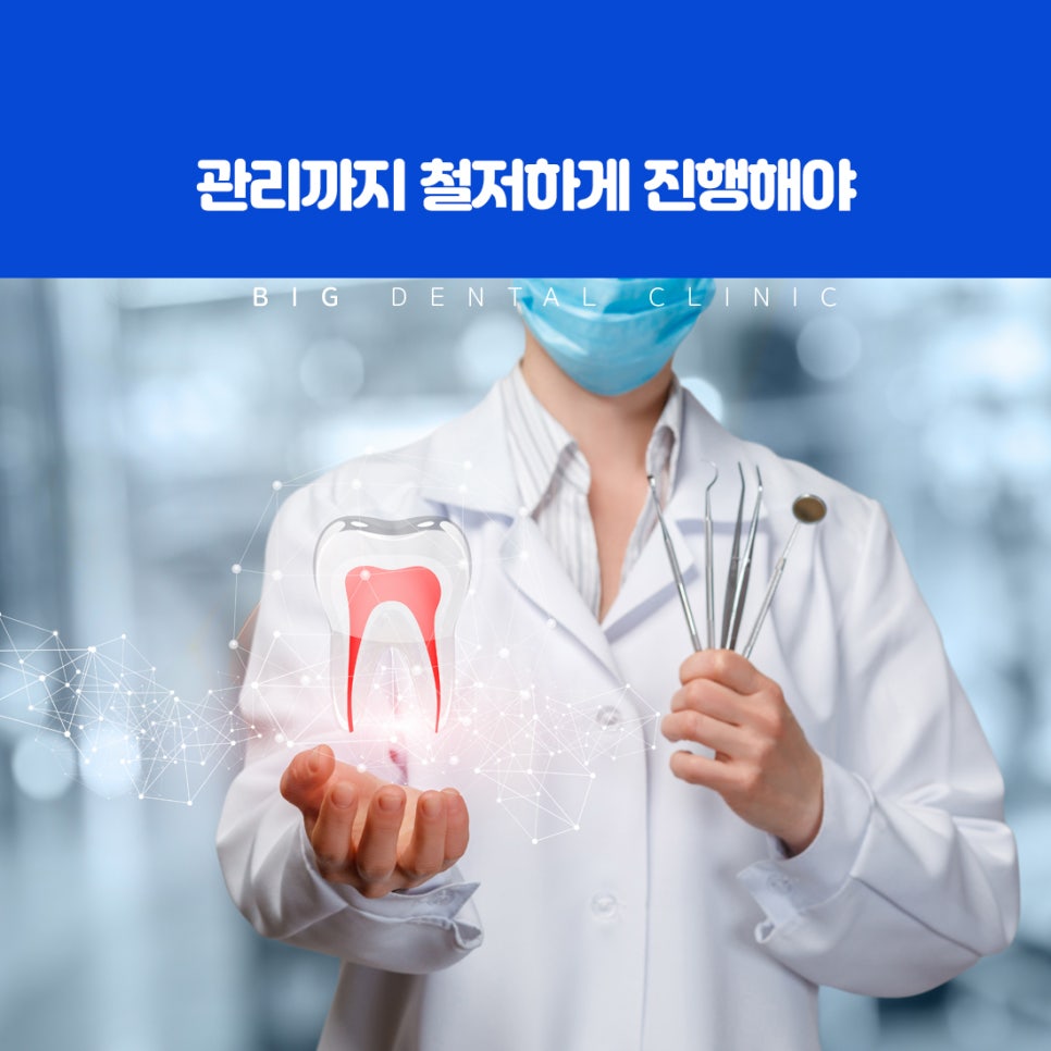 염증으로 잇몸뼈가 약해져 결국 발치가 필요해진 치아 상태