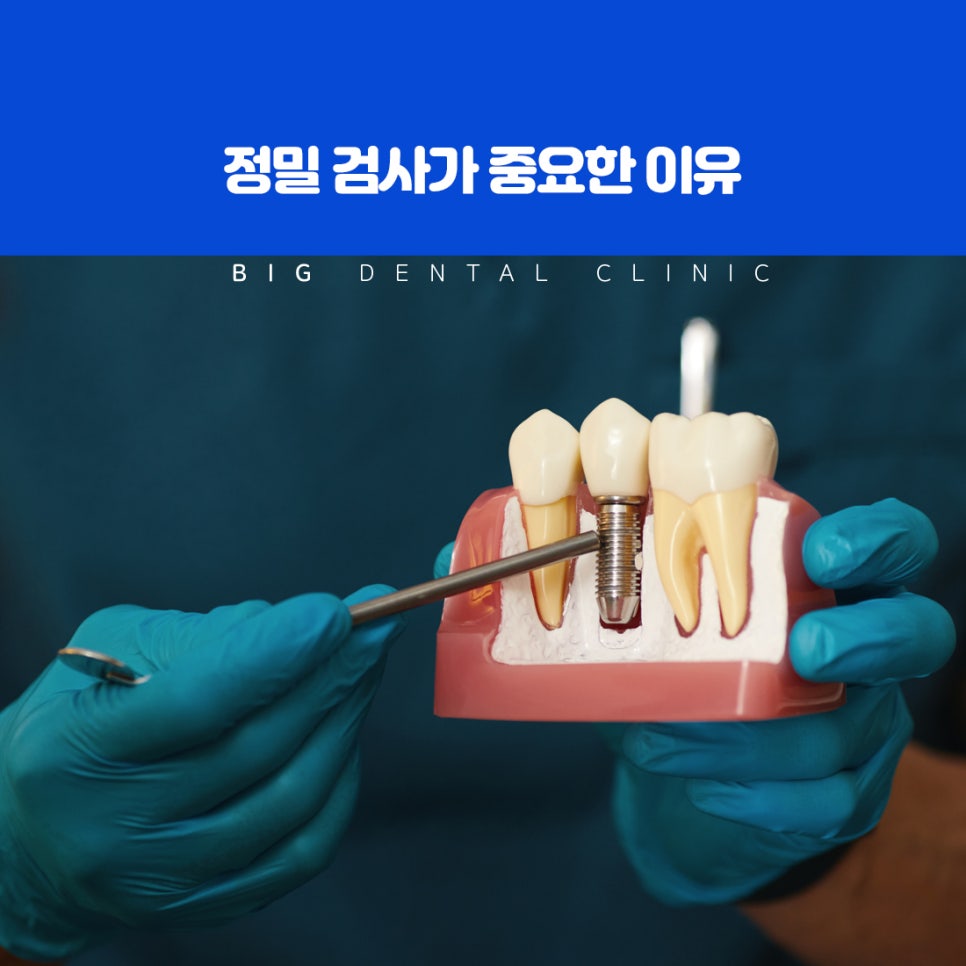 심한 염증이나 감염 없이 건강하게 유지된 발치 부위 잇몸