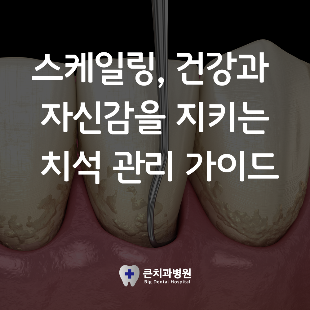 울산북구스케일링