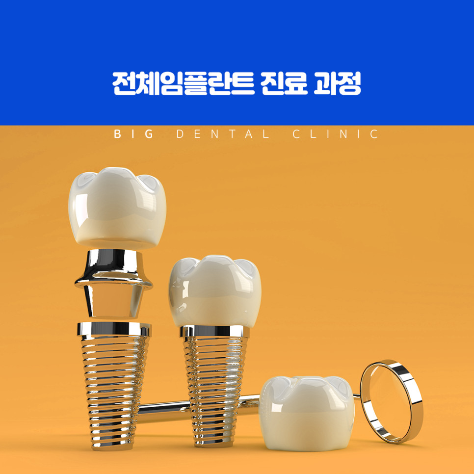틀니보다 흔들림이 적어 구강 구조를 안정적으로 유지하는 전체임플란트의 장점