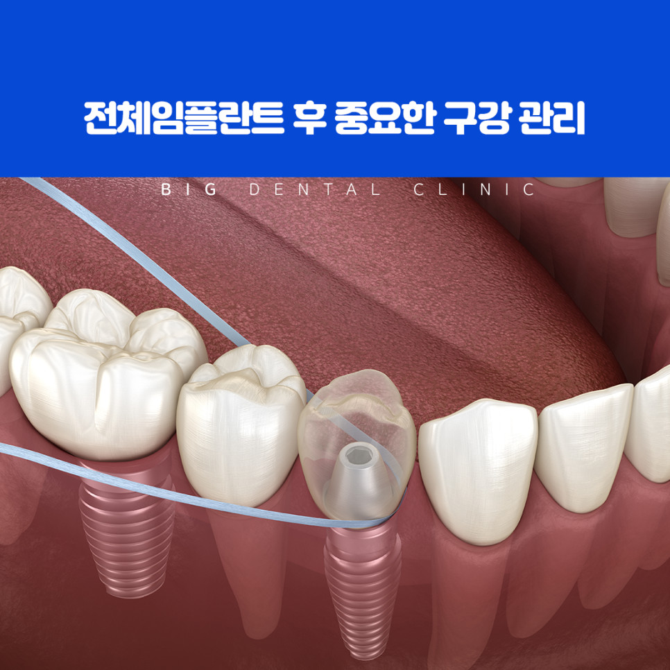정밀 진단 장비와 협진 체계, 사후 관리 계획을 기준으로 고르는 치과