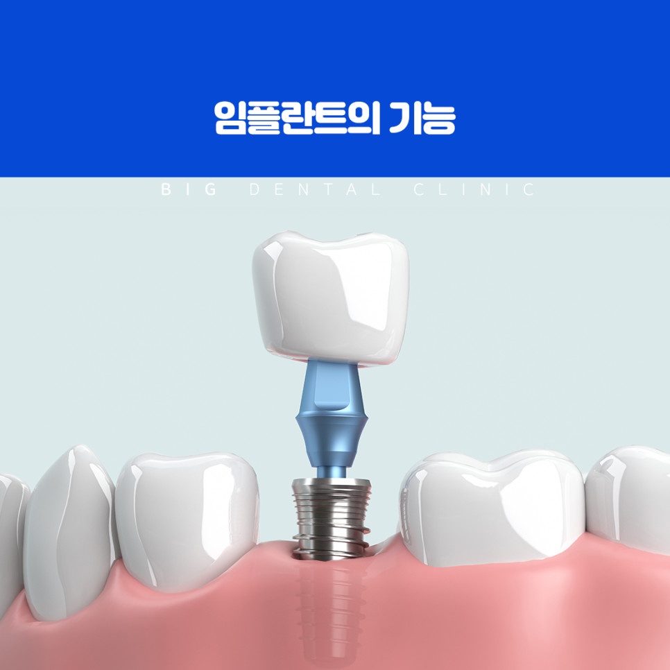 치아 상실의 원인에 따라 남은 치아와 잇몸 뼈 상태가 달라지는 모습