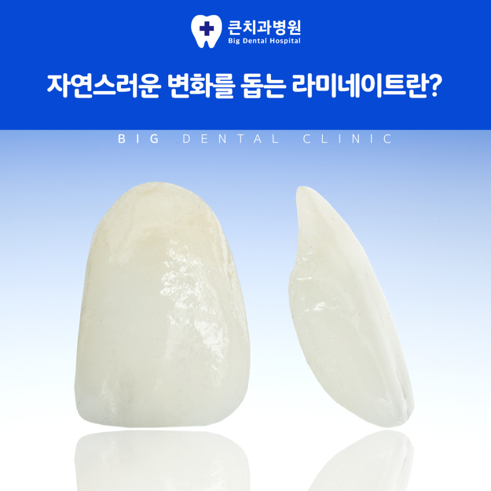 미백이나 교정만으로 아쉬운 부분을 짧은 과정으로 보완하는 라미네이트